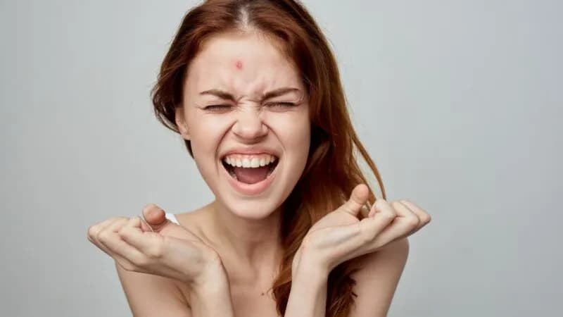 Pryszcz? Szybkie metody: domowe i apteczne sposoby na pozbycie się go