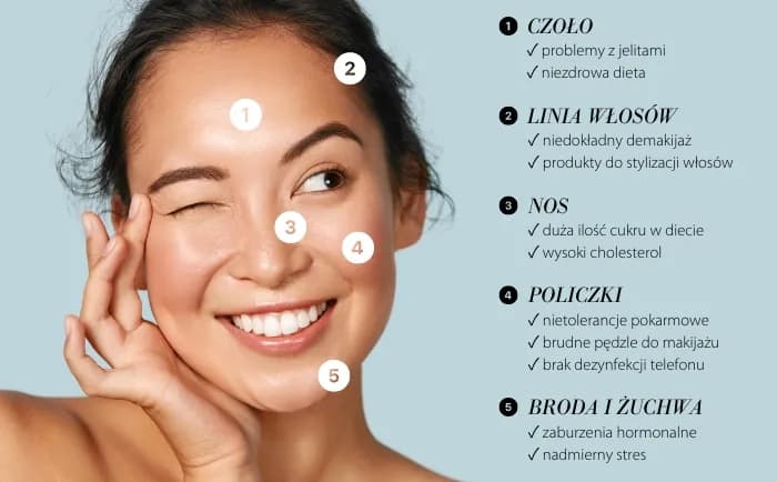 Od czego pryszcze? Poznaj przyczyny i skuteczne rozwiązania