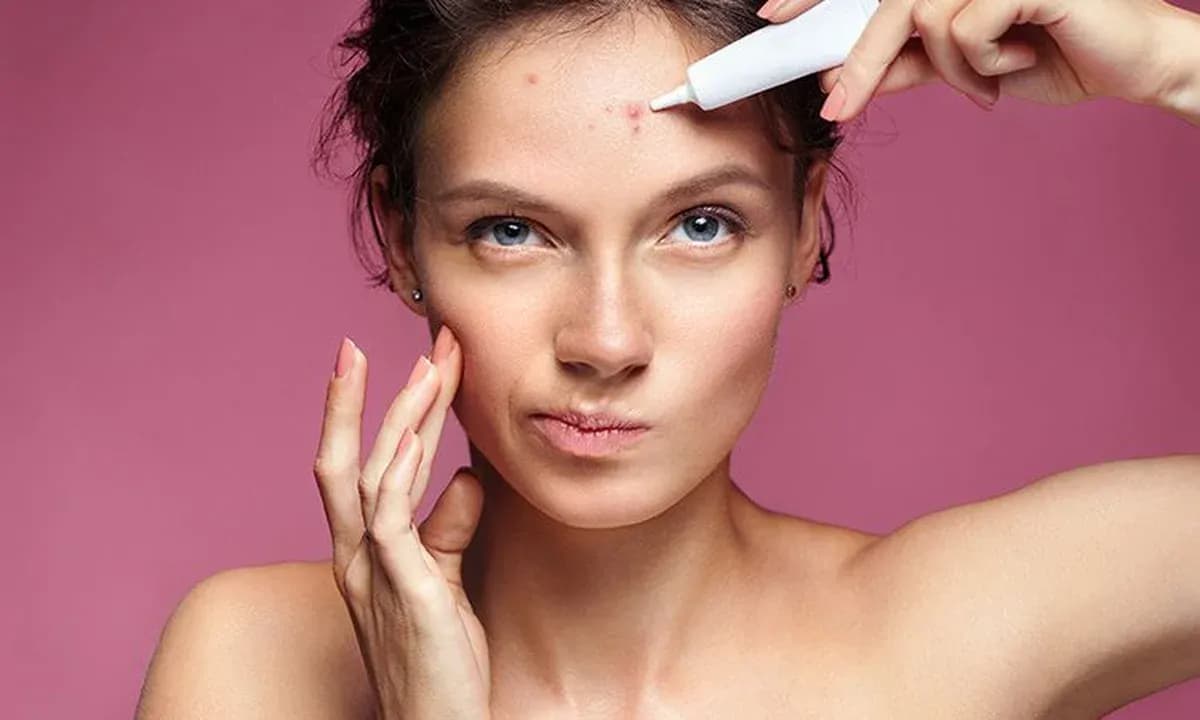 Szybkie sposoby na pryszcze: Domowe i apteczne metody na czystą cerę